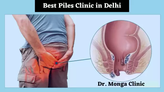 Best Piles Clinic in Delhi: Dr. Monga Clinic