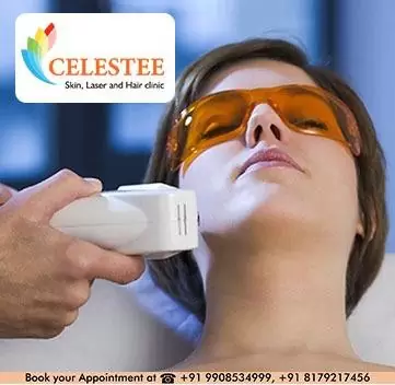 Best Permanent Laser Hair Removal in Hyderabad